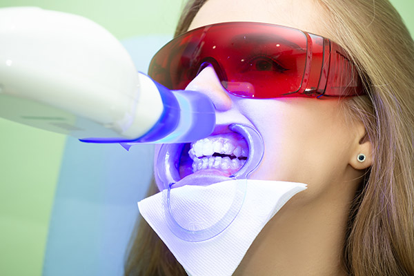 What Should You Not Do After Zoom Teeth Whitening?
